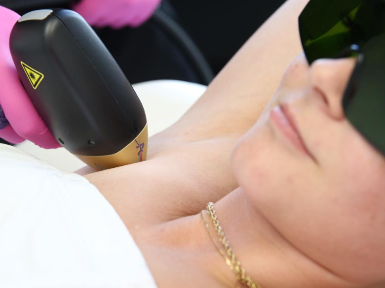 Bon d'achat sur l'épilation définitive au laser
