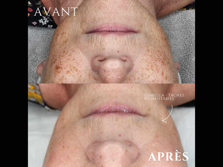 Photo – Clinique ÈvaDerme 2025 – 5