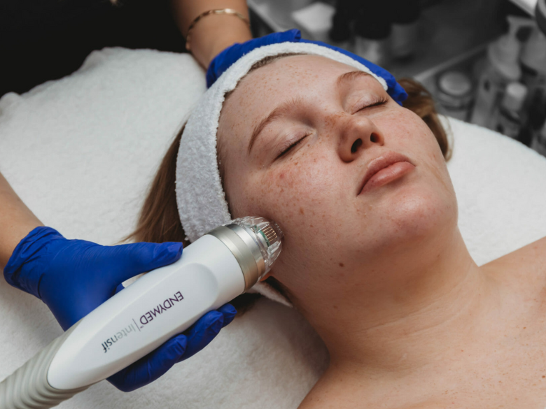 Photo – Axé Beauté – Microneedling – 1