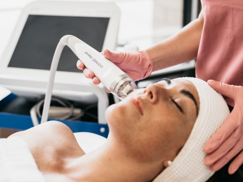 Cure de 3 microneedling radio-fréquence