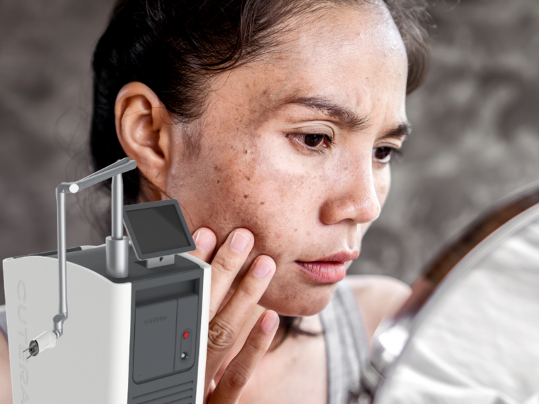 Cure photorajeunissement laser par pico-pigmentaire
